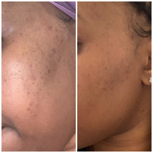Load image into Gallery viewer, Exfoliating Scrub (Step 1) - ATasteOfIcee Kollection